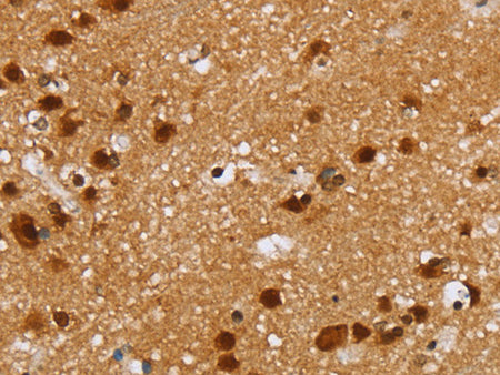 ZMAT3 Polyclonal Antibody Store at -20°C, Biomarkers, Elabscience Biotechnology, MSE Supplies
