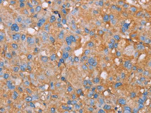 PAGE5 Polyclonal Antibody Store at -20°C, Biomarkers, Elabscience Biotechnology, MSE Supplies