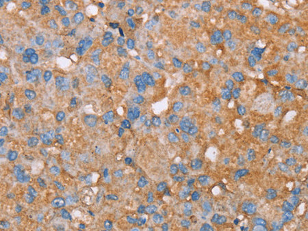 PAGE5 Polyclonal Antibody Store at -20°C, Biomarkers, Elabscience Biotechnology, MSE Supplies