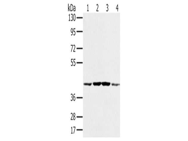PAICS Polyclonal Antibody Store at -20°C, Biomarkers, Elabscience Biotechnology, MSE Supplies