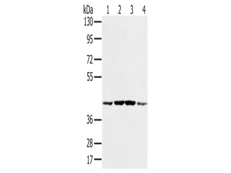 PAICS Polyclonal Antibody Store at -20°C, Biomarkers, Elabscience Biotechnology, MSE Supplies