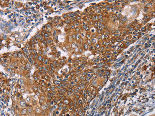 PMPCB Polyclonal Antibody Store at -20°C, Biomarkers, Elabscience Biotechnology, MSE Supplies