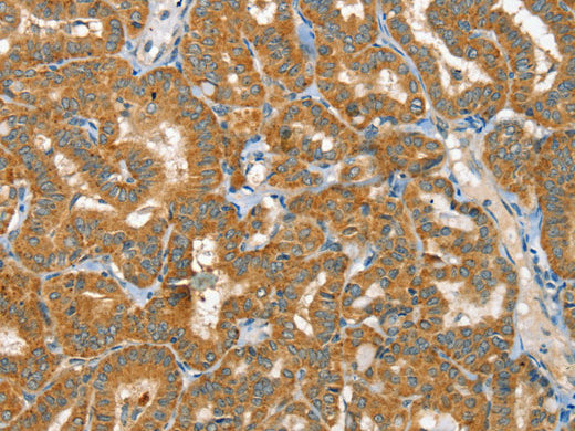 RAB25 Polyclonal Antibody Store at -20°C, Biomarkers, Elabscience Biotechnology, MSE Supplies