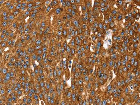 RASSF3 Polyclonal Antibody Store at -20°C, Biomarkers, Elabscience Biotechnology, MSE Supplies