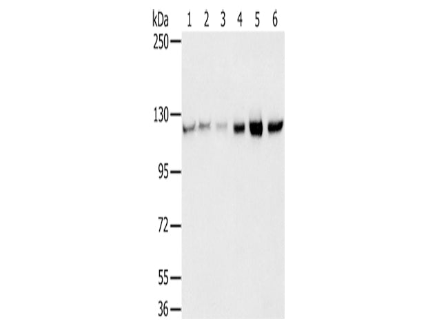 RBM5 Polyclonal Antibody Store at -20°C, Biomarkers, Elabscience Biotechnology, MSE Supplies