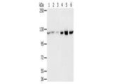 RBM5 Polyclonal Antibody Store at -20°C, Biomarkers, Elabscience Biotechnology, MSE Supplies