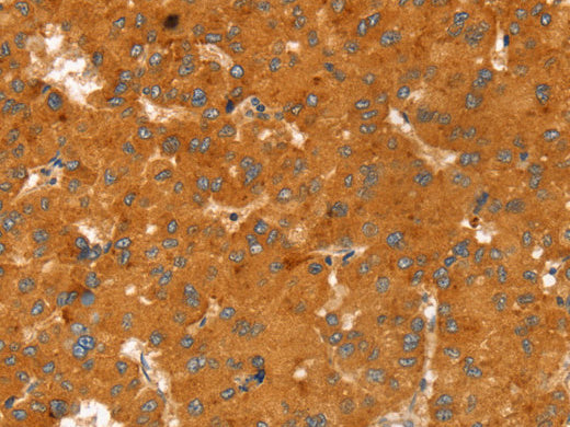 RGS4 Polyclonal Antibody Store at -20°C, Biomarkers, Elabscience Biotechnology, MSE Supplies