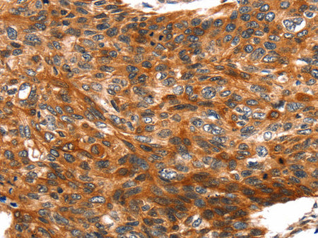 TRIM69 Polyclonal Antibody Store at -20°C, Biomarkers, Elabscience Biotechnology, MSE Supplies