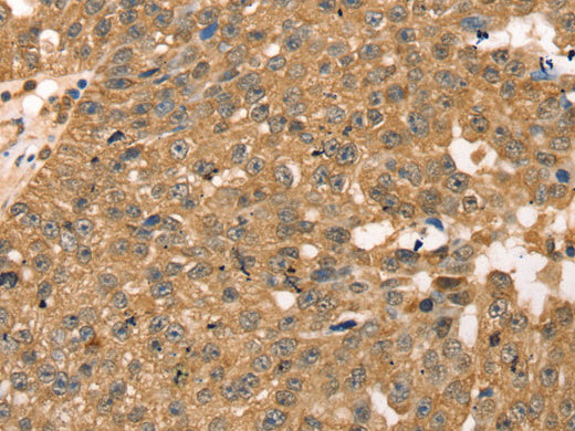 RPLP2 Polyclonal Antibody Store at -20°C, Biomarkers, Elabscience Biotechnology, MSE Supplies