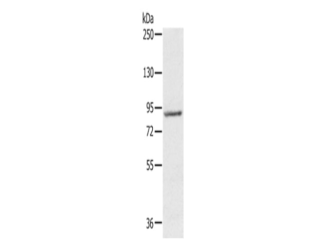 RPS6KA1 Polyclonal Antibody Store at -20°C, Biomarkers, Elabscience Biotechnology, MSE Supplies