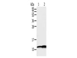 S100A11 Polyclonal Antibody Store at -20°C, Biomarkers, Elabscience Biotechnology, MSE Supplies
