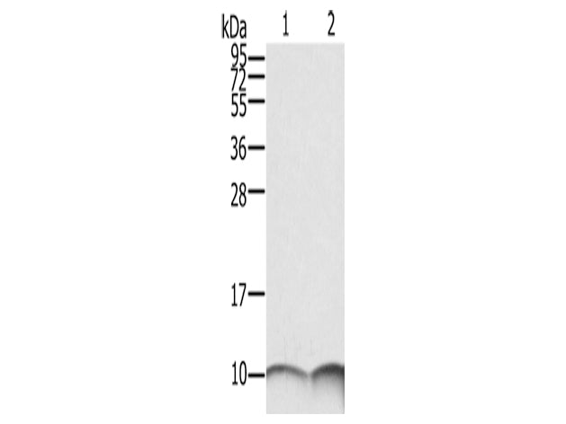 S100A6 Polyclonal Antibody Store at -20°C, Biomarkers, Elabscience Biotechnology, MSE Supplies