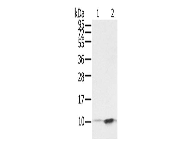 S100P Polyclonal Antibody Store at -20°C, Biomarkers, Elabscience Biotechnology, MSE Supplies