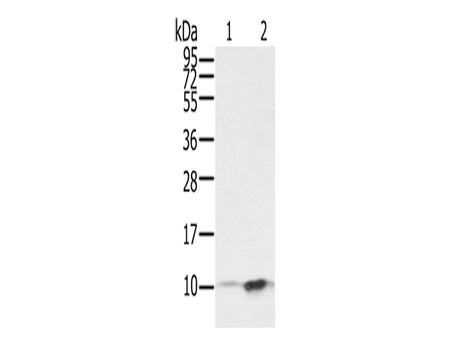 S100P Polyclonal Antibody Store at -20°C, Biomarkers, Elabscience Biotechnology, MSE Supplies
