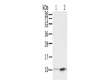 S100P Polyclonal Antibody Store at -20°C, Biomarkers, Elabscience Biotechnology, MSE Supplies