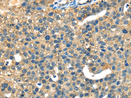 DHCR24 Polyclonal Antibody Store at -20°C, Biomarkers, Elabscience Biotechnology, MSE Supplies