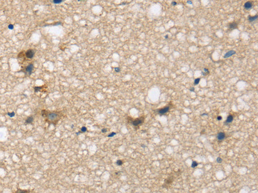 SEMA4A Polyclonal Antibody Store at -20°C, Biomarkers, Elabscience Biotechnology, MSE Supplies