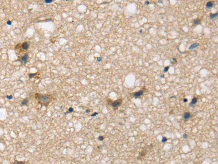 SEMA4A Polyclonal Antibody Store at -20°C, Biomarkers, Elabscience Biotechnology, MSE Supplies