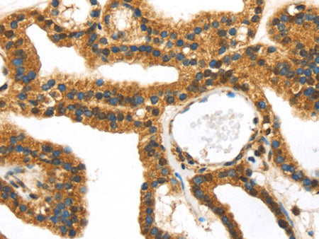 SERPINB8 Polyclonal Antibody Store at -20°C, Biomarkers, Elabscience Biotechnology, MSE Supplies