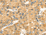 SH3KBP1 Polyclonal Antibody Store at -20°C, Biomarkers, Elabscience Biotechnology, MSE Supplies