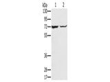 SLC25A13 Polyclonal Antibody Store at -20°C, Biomarkers, Elabscience Biotechnology, MSE Supplies