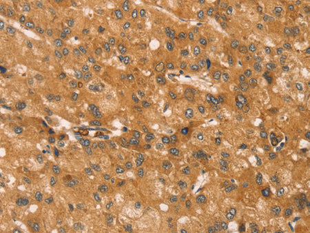 SNAP29 Polyclonal Antibody Store at -20°C, Biomarkers, Elabscience Biotechnology, MSE Supplies