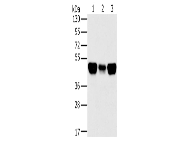 TRIM21 Polyclonal Antibody Store at -20°C, Biomarkers, Elabscience Biotechnology, MSE Supplies
