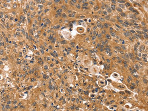 SSX2IP Polyclonal Antibody Store at -20°C, Biomarkers, Elabscience Biotechnology, MSE Supplies