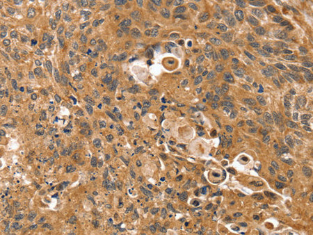 SSX2IP Polyclonal Antibody Store at -20°C, Biomarkers, Elabscience Biotechnology, MSE Supplies