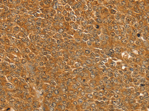 ST18 Polyclonal Antibody Store at -20°C, Biomarkers, Elabscience Biotechnology, MSE Supplies