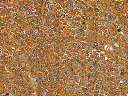 ST18 Polyclonal Antibody Store at -20°C, Biomarkers, Elabscience Biotechnology, MSE Supplies