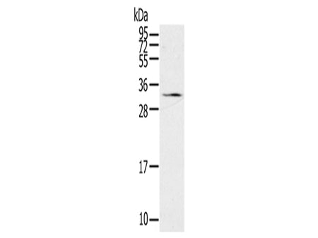 STAR Polyclonal Antibody Store at -20°C, Biomarkers, Elabscience Biotechnology, MSE Supplies