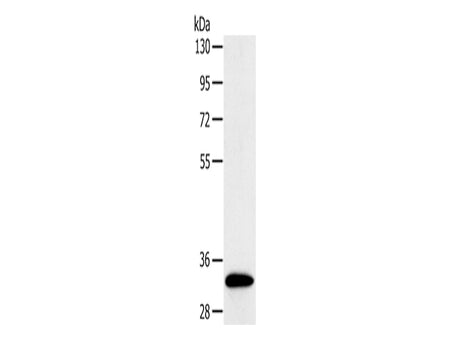 SULT1B1 Polyclonal Antibody Store at -20°C, Biomarkers, Elabscience Biotechnology, MSE Supplies