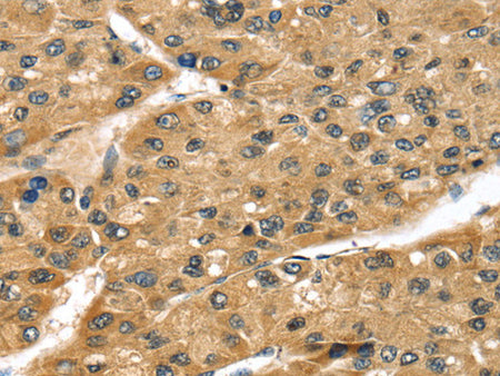 STX8 Polyclonal Antibody Store at -20°C, Biomarkers, Elabscience Biotechnology, MSE Supplies