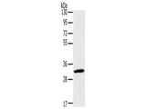 STX11 Polyclonal Antibody Store at -20°C, Biomarkers, Elabscience Biotechnology, MSE Supplies