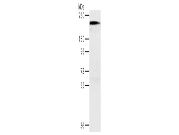 ACE1 Polyclonal Antibody Store at -20°C, Biomarkers, Elabscience Biotechnology, MSE Supplies