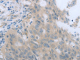 TNK2 Polyclonal Antibody Store at -20°C, Biomarkers, Elabscience Biotechnology, MSE Supplies