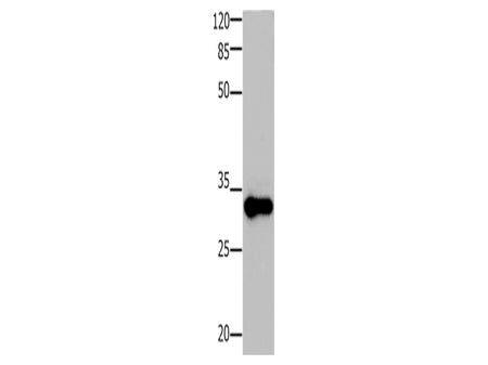 ADO Polyclonal Antibody Store at -20°C, Biomarkers, Elabscience Biotechnology, MSE Supplies