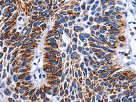RAB25 Polyclonal Antibody Store at -20°C, Biomarkers, Elabscience Biotechnology, MSE Supplies