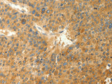 RAB35 Polyclonal Antibody Store at -20°C, Biomarkers, Elabscience Biotechnology, MSE Supplies