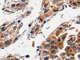 RAB41 Polyclonal Antibody Store at -20°C, Biomarkers, Elabscience Biotechnology, MSE Supplies