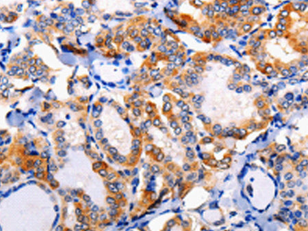 AP1B1 Polyclonal Antibody Store at -20°C, Biomarkers, Elabscience Biotechnology, MSE Supplies