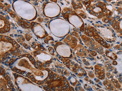 FABP3 Polyclonal Antibody Store at -20°C, Biomarkers, Elabscience Biotechnology, MSE Supplies