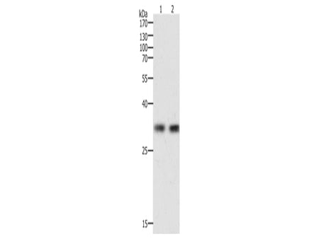 HAVCR1 Polyclonal Antibody Store at -20°C, Biomarkers, Elabscience Biotechnology, MSE Supplies