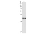 HAVCR1 Polyclonal Antibody Store at -20°C, Biomarkers, Elabscience Biotechnology, MSE Supplies