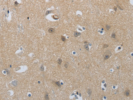 NPR1 Polyclonal Antibody Store at -20°C, Biomarkers, Elabscience Biotechnology, MSE Supplies