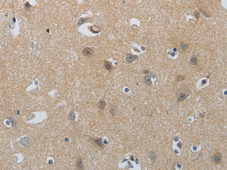 NPR1 Polyclonal Antibody Store at -20°C, Biomarkers, Elabscience Biotechnology, MSE Supplies