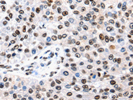 AQP2 Polyclonal Antibody Store at -20°C, Biomarkers, Elabscience Biotechnology, MSE Supplies
