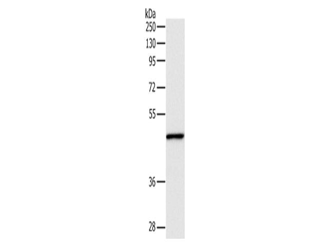 INHBA Polyclonal Antibody Store at -20°C, Biomarkers, Elabscience Biotechnology, MSE Supplies