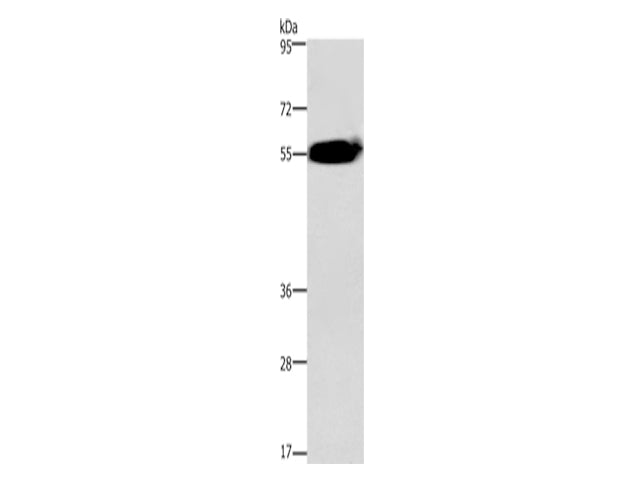 ACVR2A Polyclonal Antibody Store at -20°C, Biomarkers, Elabscience Biotechnology, MSE Supplies
